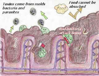 a_drawing_bad_intestines_4 a_drawing_bad_intestines_4