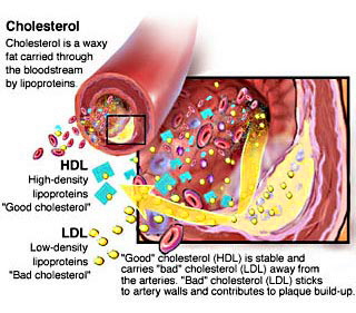 cholesterol