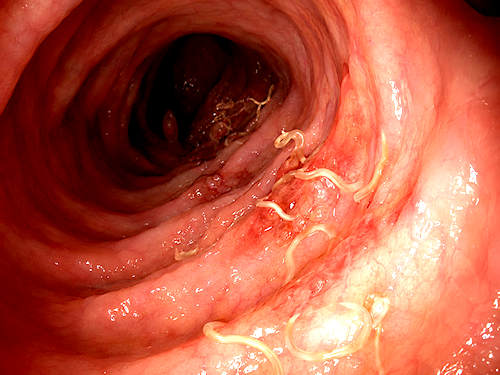 parasites